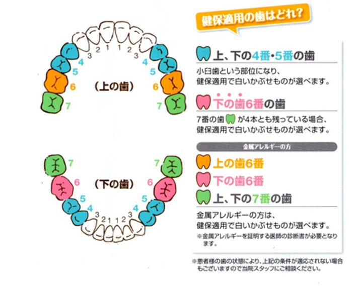 保険で白い歯に 保険適用のcad ｃam冠ってどんなもの 甲府市の歯医者なら 降矢歯科クリニック 歯科 矯正