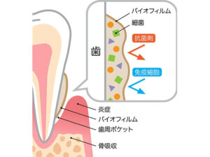 甲府市の歯医者なら、降矢歯科クリニック 歯科・矯正