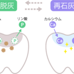 甲府市の歯医者なら、降矢歯科クリニック 歯科・矯正で初期虫歯の再石灰化が起こりにくい人にはどんな特徴がある？生活習慣や口内環境を解説