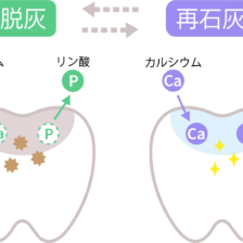甲府市の歯医者なら、降矢歯科クリニック 歯科・矯正で初期虫歯の再石灰化が起こりにくい人にはどんな特徴がある？生活習慣や口内環境を解説