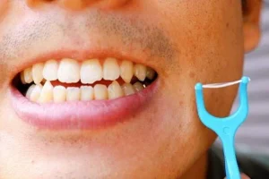 甲府市の歯医者、降矢歯科クリニック 歯科・矯正で前歯の裏側に歯石がつきやすい理由と落とす方法を解説